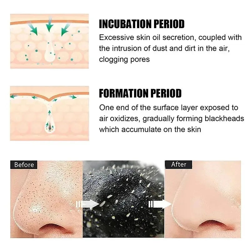 SUAKE Nose Pore Strips Blackhead Removal Mask For Clear Pores