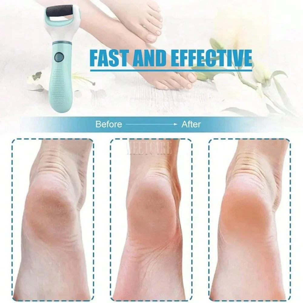Foot File Callus Remover Tool For Dead Skin Care Professional